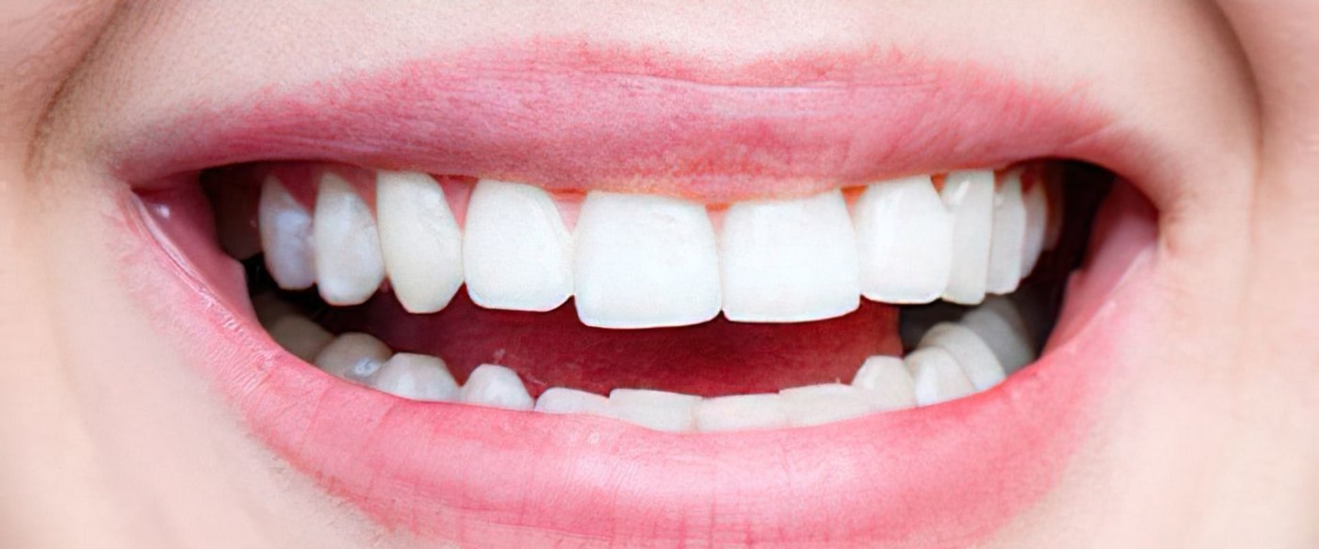 How A Dentist In Kansas City Can Help You Achieve Your Perfect Smile Makeover?